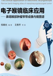孕妇梦见勾鱼